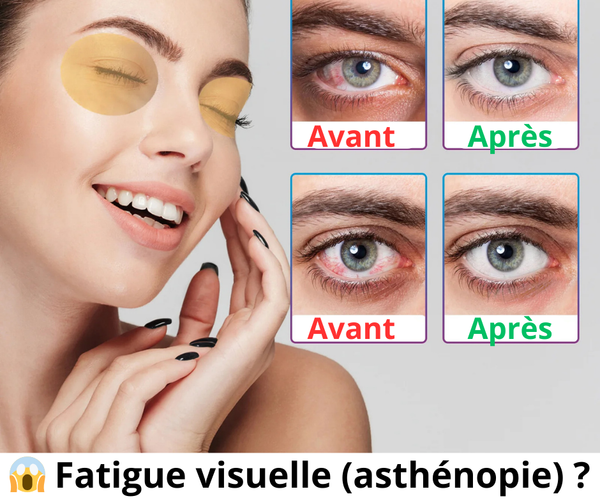 Gouttes oculaires lubrifiantes pour la cataracte et le glaucome EELHOE™